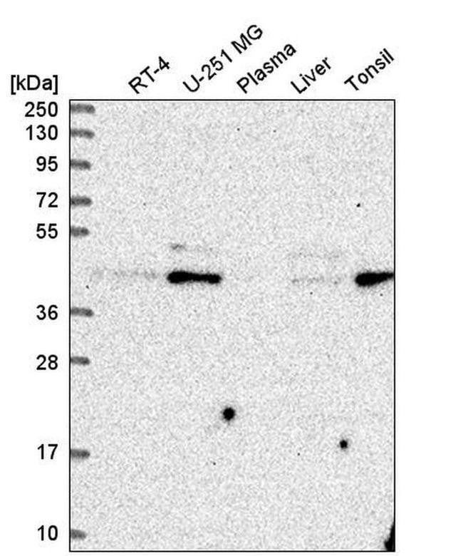 ZDHHC16 Antibody in Western Blot (WB)