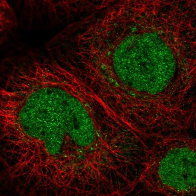 C11orf63 Antibody in Immunocytochemistry (ICC/IF)