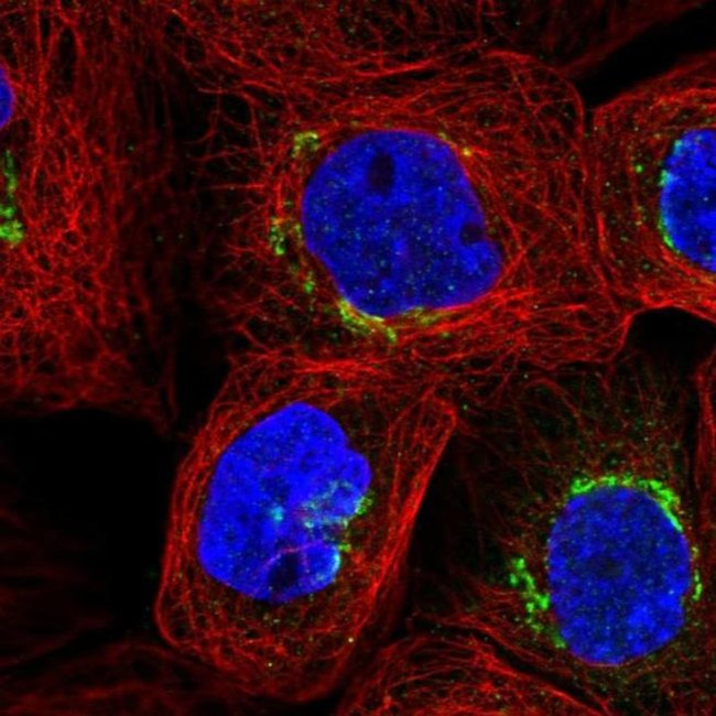 GLB1 Antibody in Immunocytochemistry (ICC/IF)