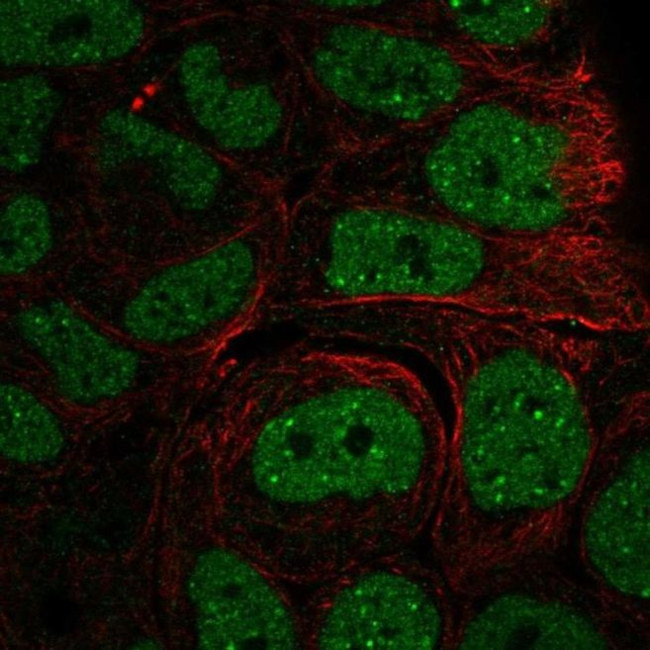 INO80 Antibody in Immunocytochemistry (ICC/IF)