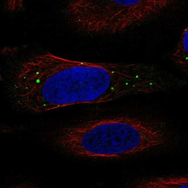 IGIP Antibody in Immunocytochemistry (ICC/IF)