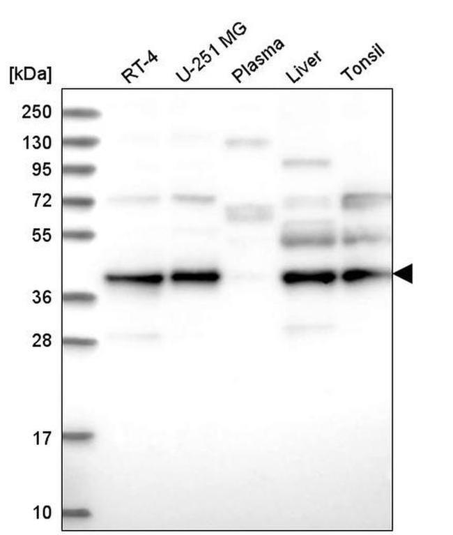 UBL7 Antibody in Western Blot (WB)