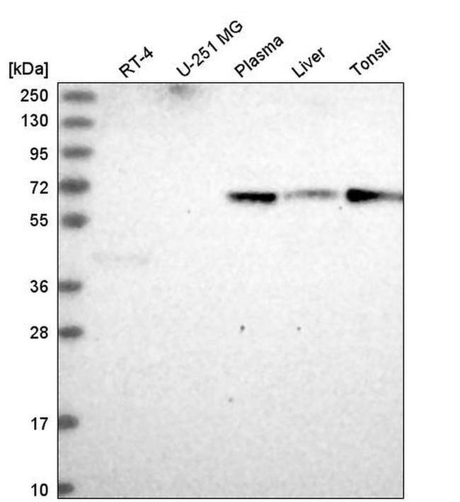 ITPRIPL2 Antibody in Western Blot (WB)