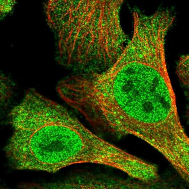 N4BP2 Antibody in Immunocytochemistry (ICC/IF)