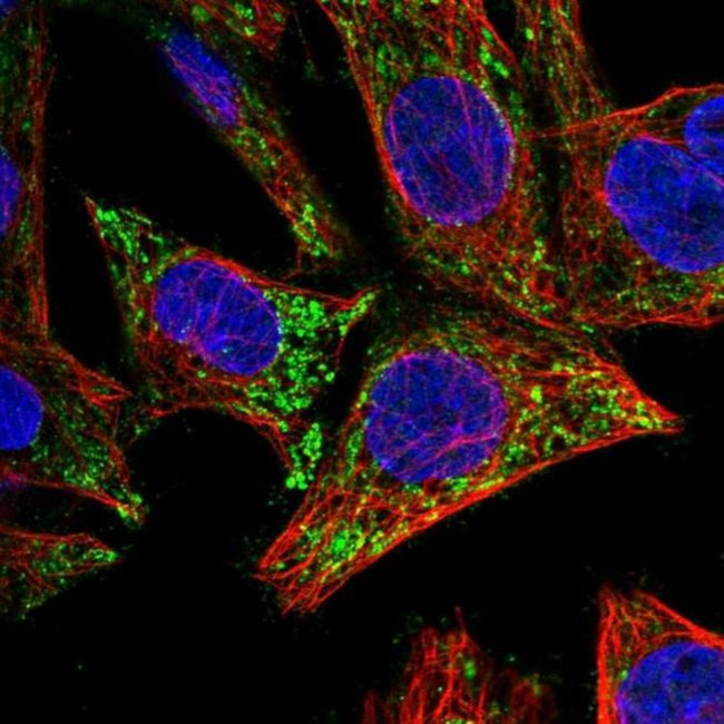 ICAT Antibody in Immunocytochemistry (ICC/IF)