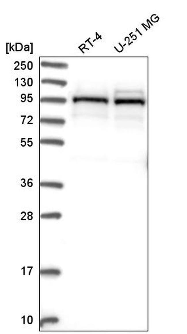 LAR4B Antibody in Western Blot (WB)