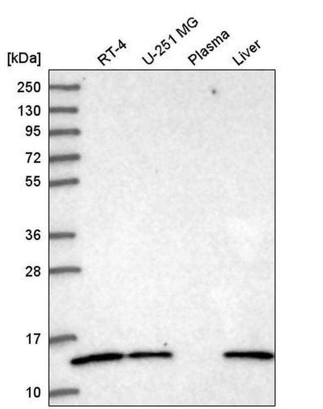 V-ATPase G1 Antibody in Western Blot (WB)