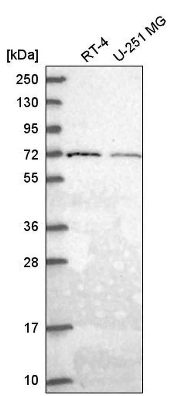 GGA2 Antibody in Western Blot (WB)
