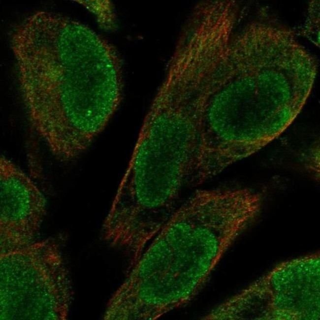 UACA Antibody in Immunocytochemistry (ICC/IF)