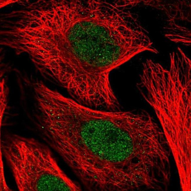 KDELC1 Antibody in Immunocytochemistry (ICC/IF)