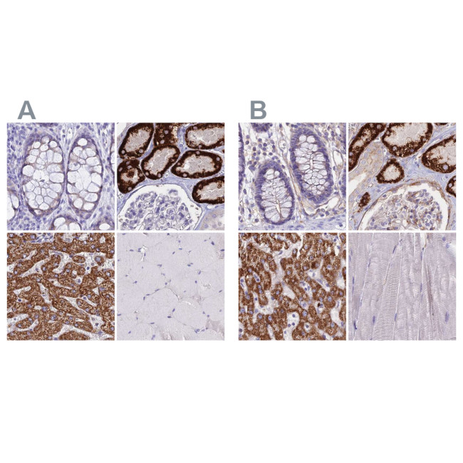 GLYAT Antibody in Immunohistochemistry (IHC)