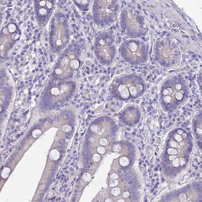 GLYAT Antibody in Immunohistochemistry (IHC)