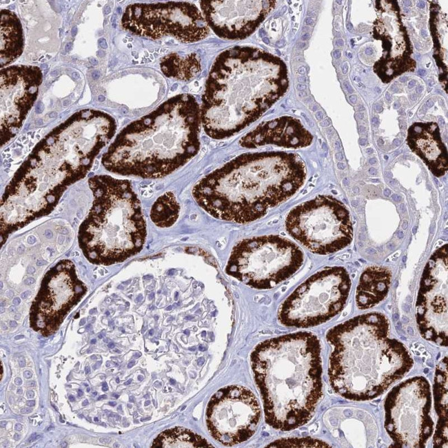 GLYAT Antibody in Immunohistochemistry (IHC)