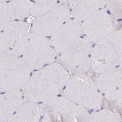 GLYAT Antibody in Immunohistochemistry (IHC)