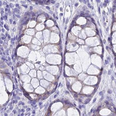 GLYAT Antibody in Immunohistochemistry (IHC)