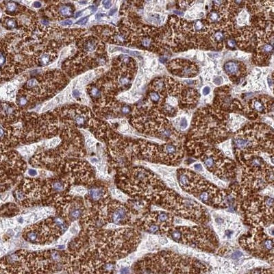 GLYAT Antibody in Immunohistochemistry (IHC)