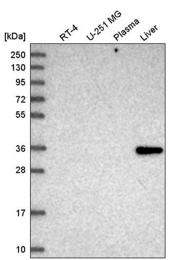 GLYAT Antibody in Western Blot (WB)