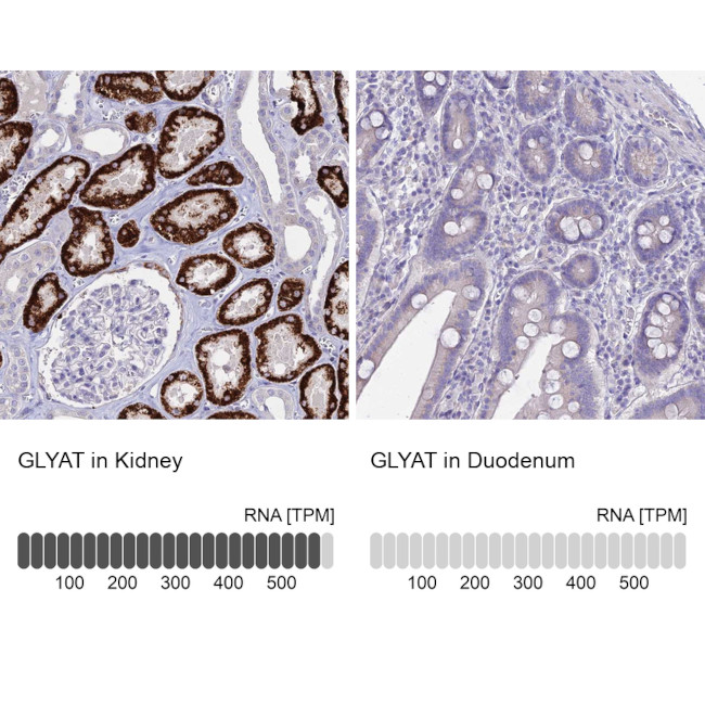 GLYAT Antibody