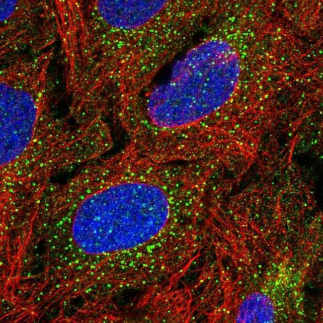 TBX4 Antibody in Immunocytochemistry (ICC/IF)