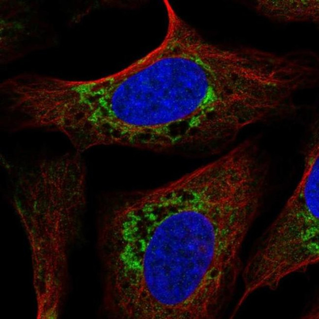 USMG5 Antibody in Immunocytochemistry (ICC/IF)