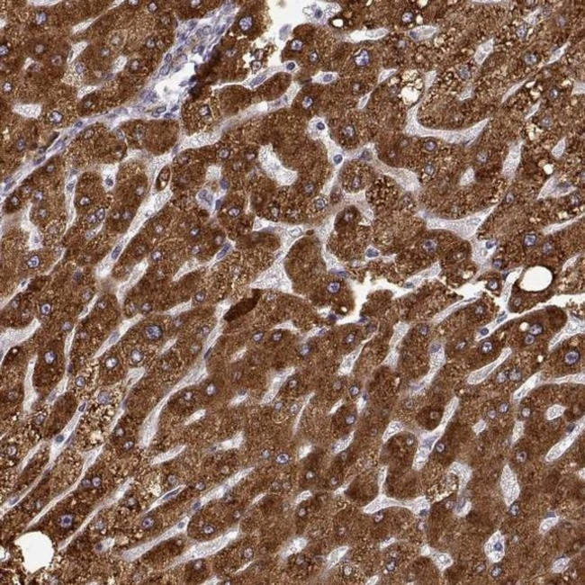 Growth Hormone Receptor Antibody in Immunohistochemistry (IHC)