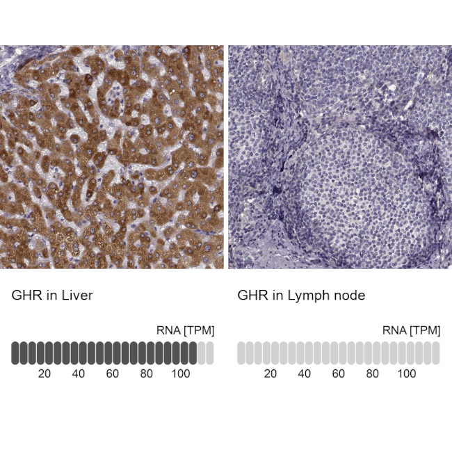 Growth Hormone Receptor Antibody