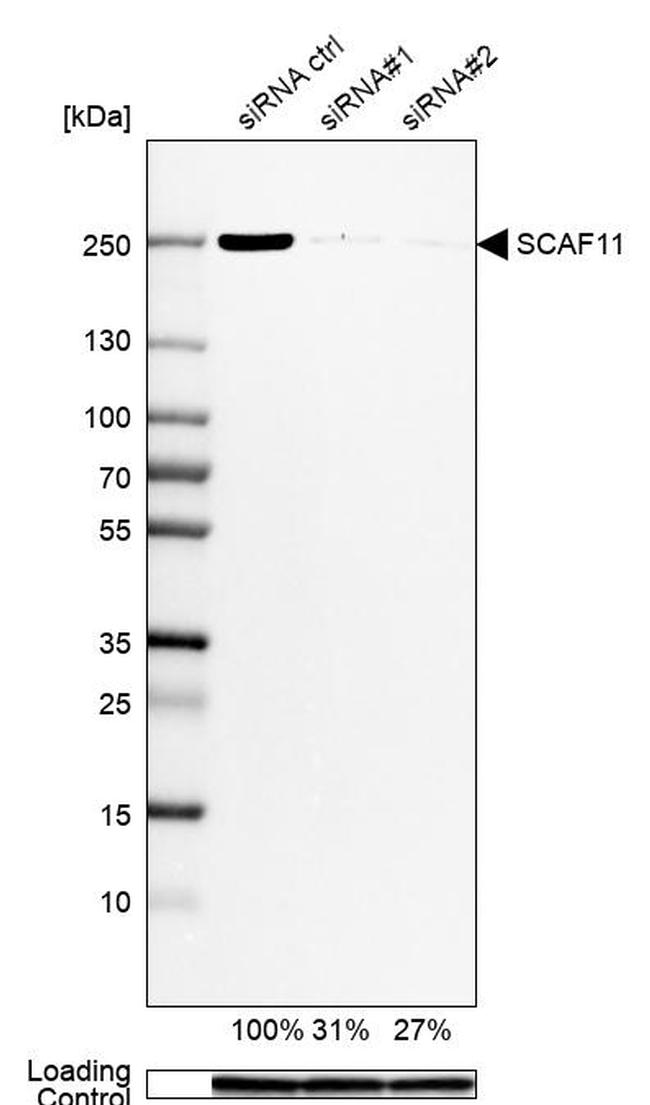 SCAF11 Antibody in Western Blot (WB)