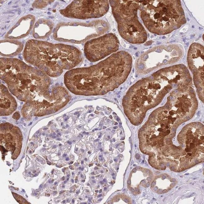 COPG Antibody in Immunohistochemistry (IHC)