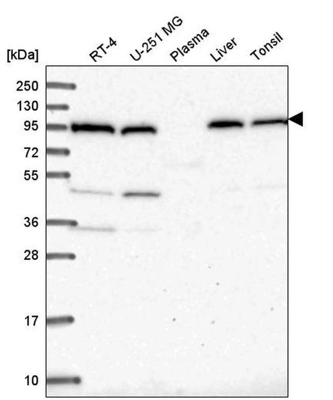 COPG Antibody in Western Blot (WB)