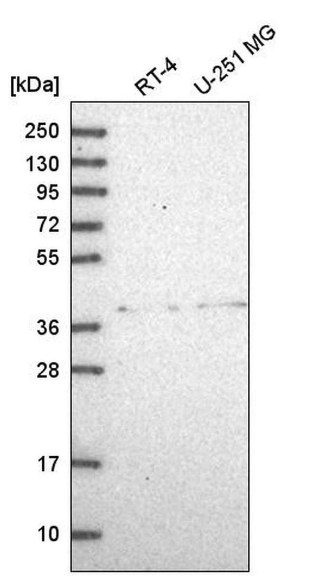 ADAL Antibody in Western Blot (WB)