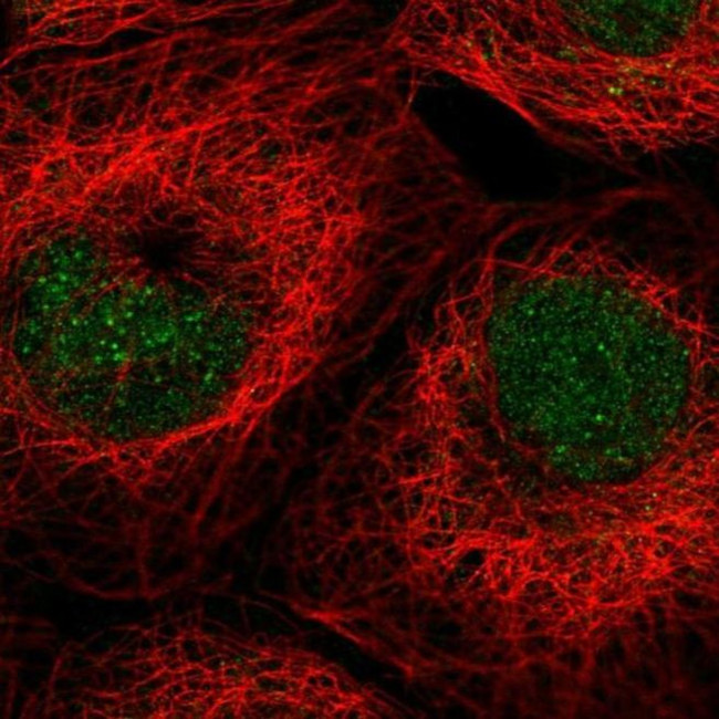 ALKBH3 Antibody in Immunocytochemistry (ICC/IF)