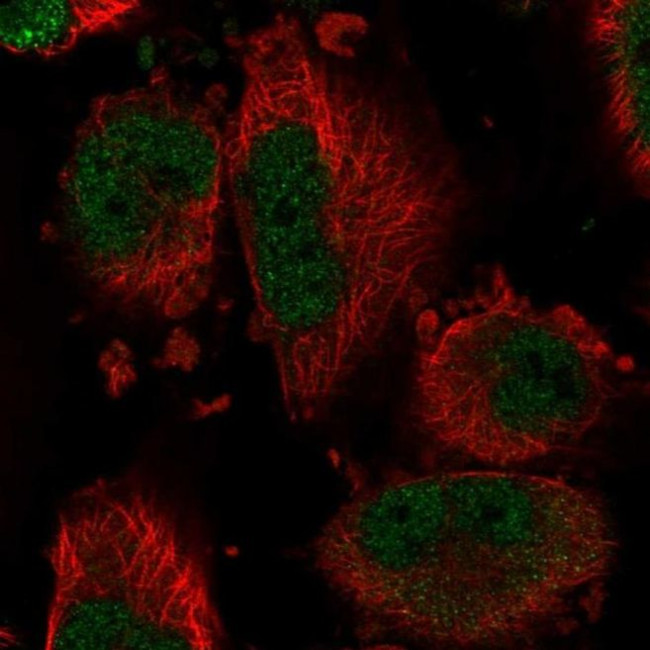 DYNLT1 Antibody in Immunocytochemistry (ICC/IF)