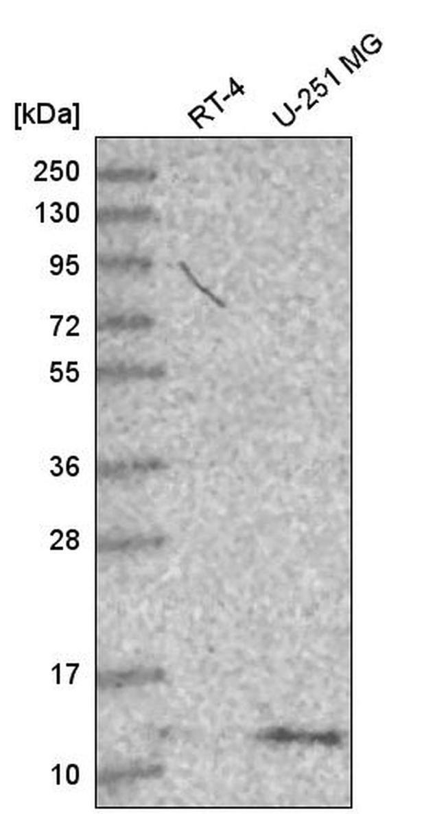 DYNLT1 Antibody in Western Blot (WB)