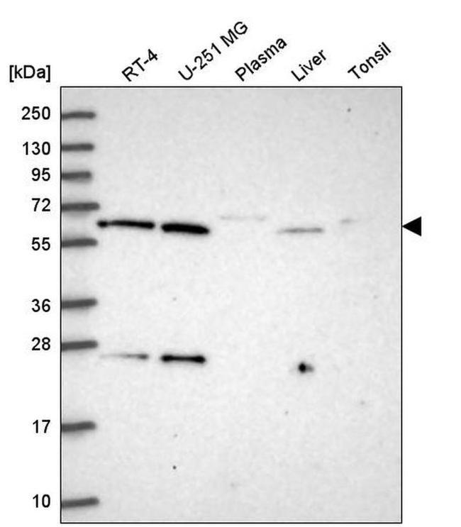 ACAD9 Antibody in Western Blot (WB)