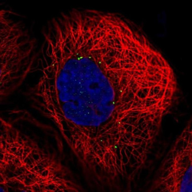 CTNS Antibody in Immunocytochemistry (ICC/IF)