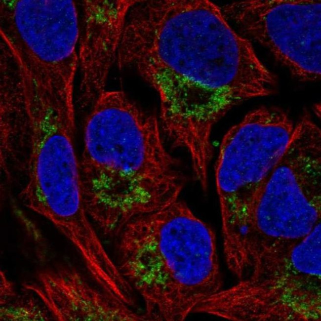 NAT14 Antibody in Immunocytochemistry (ICC/IF)