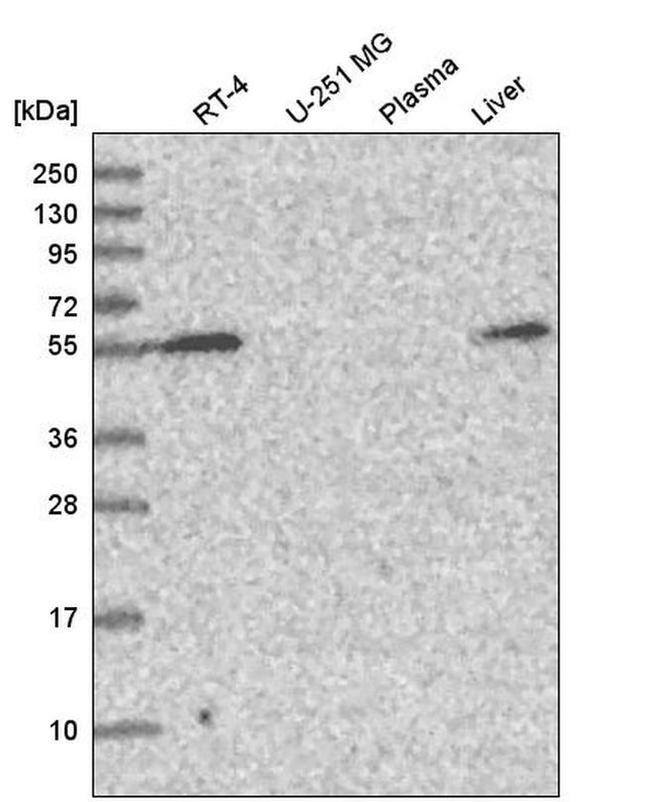 CHST3 Antibody in Western Blot (WB)