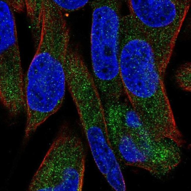 UGT3A1 Antibody in Immunocytochemistry (ICC/IF)