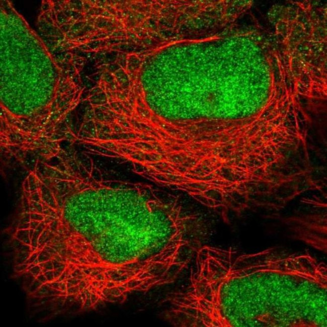 HOXB2 Antibody in Immunocytochemistry (ICC/IF)