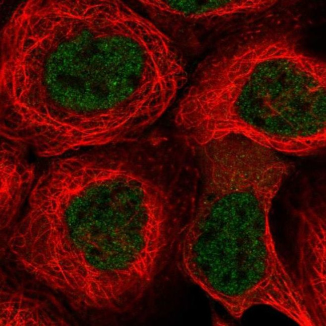 KCTD9 Antibody in Immunocytochemistry (ICC/IF)