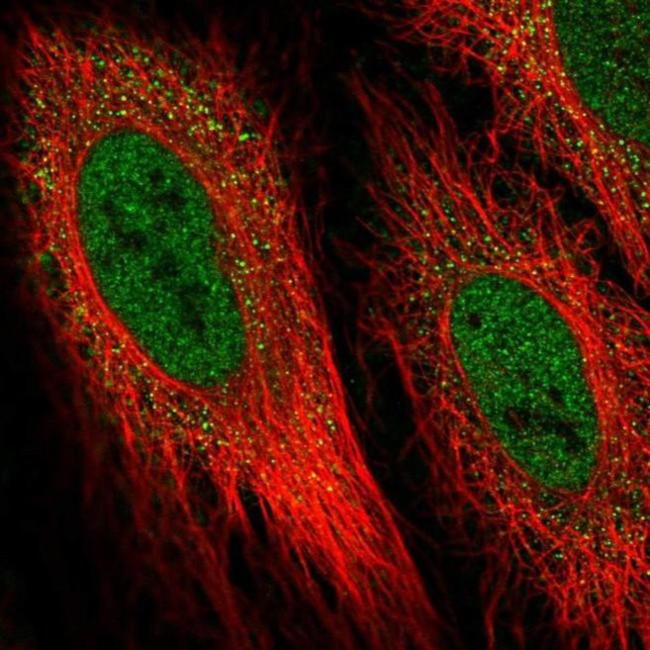 DIO2 Antibody in Immunocytochemistry (ICC/IF)