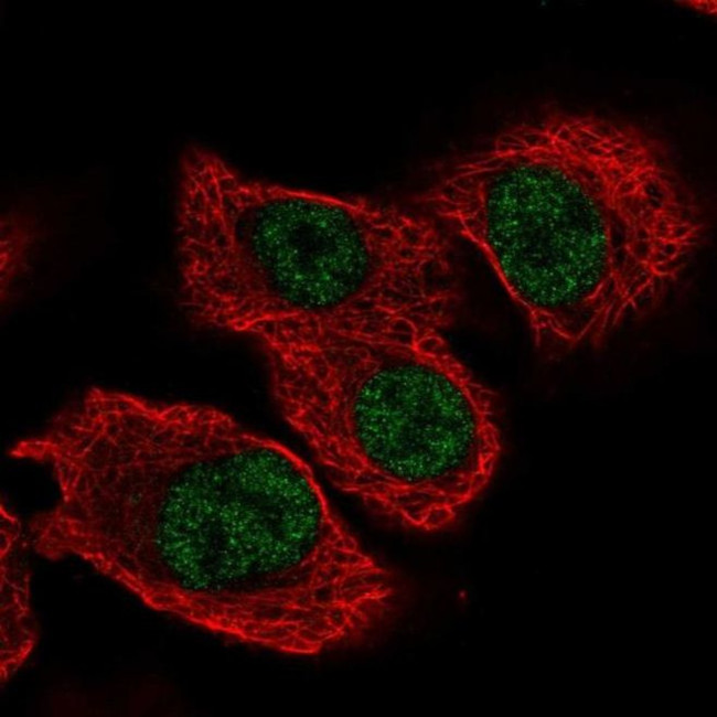 TSEN34 Antibody in Immunocytochemistry (ICC/IF)