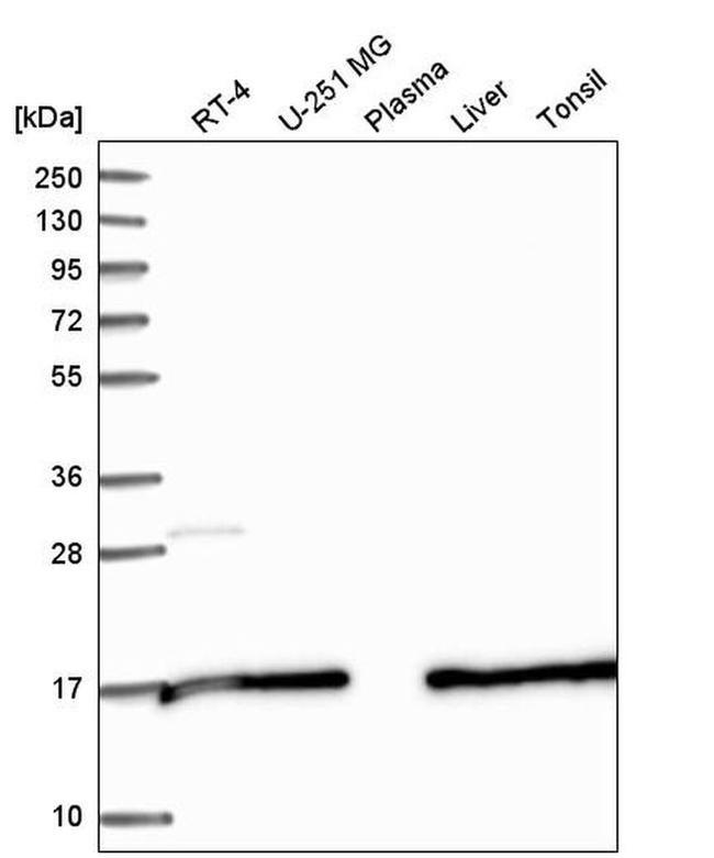 SAP30L Antibody in Western Blot (WB)