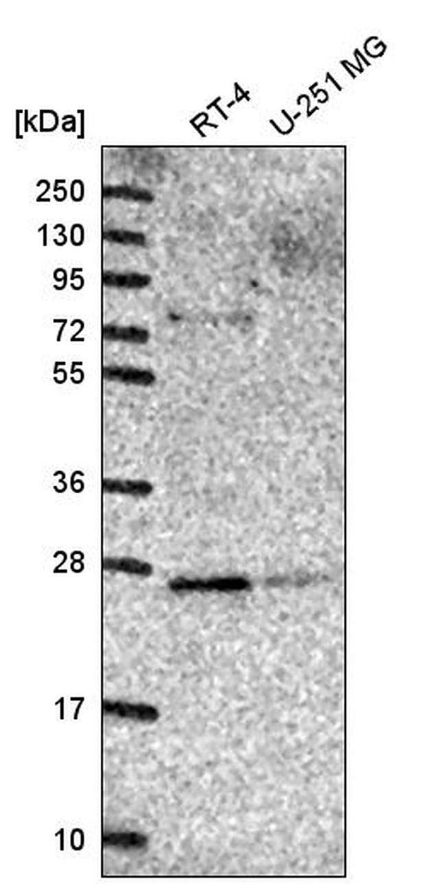 GOSR2 Antibody in Western Blot (WB)