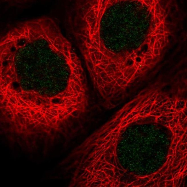 HLTF Antibody in Immunocytochemistry (ICC/IF)