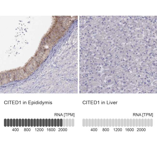 CITED1 Antibody in Immunohistochemistry (IHC)