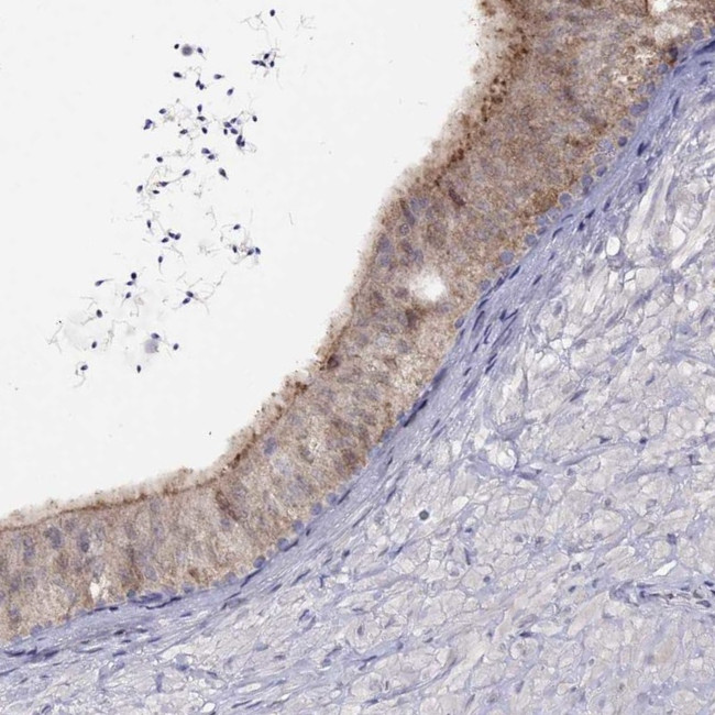 CITED1 Antibody in Immunohistochemistry (IHC)