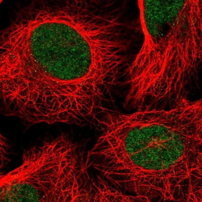 TAF11 Antibody in Immunocytochemistry (ICC/IF)