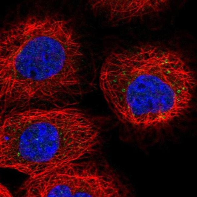 RDH10 Antibody in Immunocytochemistry (ICC/IF)