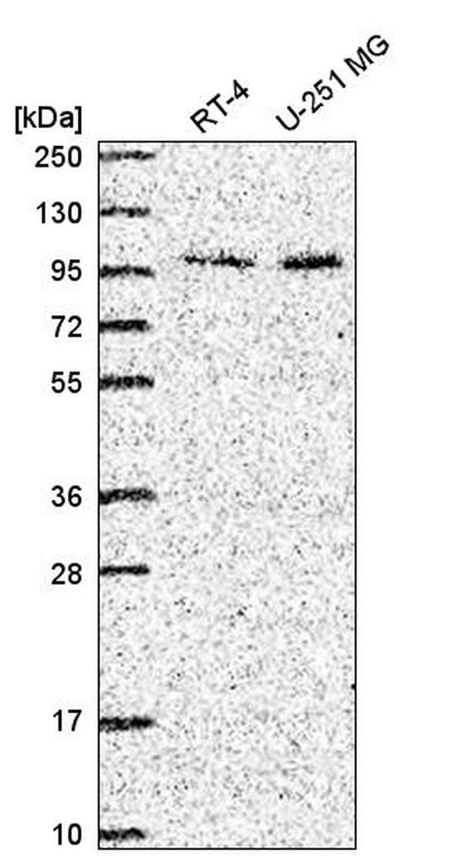 ZXDC Antibody in Western Blot (WB)